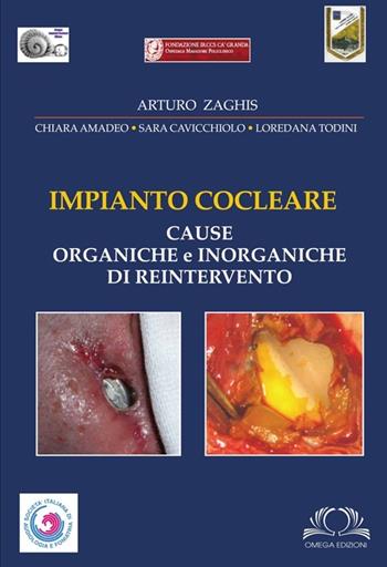 Impianto cocleare. Cause organiche e inorganiche di reintervento. Ediz. illustrata - Arturo Zaghis - Libro Omega 2014 | Libraccio.it