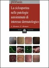 La ciclosporina nelle patologie autoimmuni di interesse dermatologico