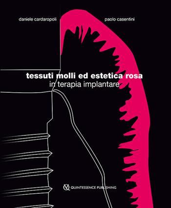 Tessuti molli ed estetica rosa in terapia implantare - Daniele Cardaropoli, Paolo Casentini - Libro Quintessenza 2018 | Libraccio.it