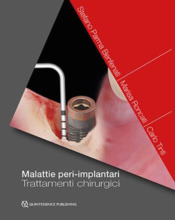 Malattie peri-implantari. Trattamenti chirurgici - Stefano Parma Benfanti, Marisa Roncati, Carlo Tinti - Libro Quintessenza 2019 | Libraccio.it