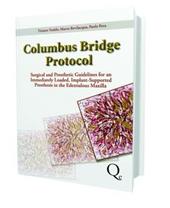 Columbus bridge protocol. Surgical and prosthetic guidelines for an immediately loaded, implant-supported prosthesis in the edentulous maxilla