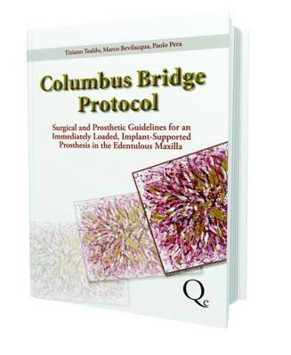 Columbus bridge protocol. Surgical and prosthetic guidelines for an immediately loaded, implant-supported prosthesis in the edentulous maxilla - Tiziano Tealdo, Marco Bevilacqua, Paolo Pera - Libro Quintessenza 2012 | Libraccio.it