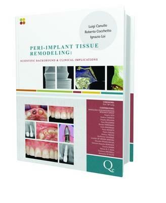 Peri-implant tissue remodeling. Scientific background and clinical implications - Luigi Canullo, Roberto Cocchetto, Ignazio Loi - Libro Quintessenza 2012 | Libraccio.it