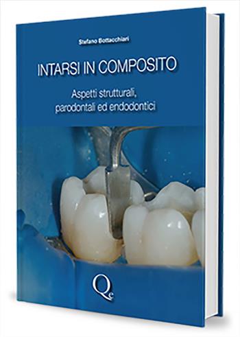 Intarsi in composito. Aspetti strutturali, parodontali ed endodontici - Stefano Bottacchiari - Libro Quintessenza 2024 | Libraccio.it