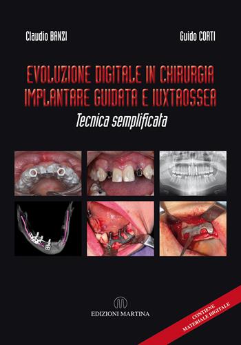 Evoluzione digitale in chirurgia implantare guidata e iuxtaossea. Tecnica semplificata. Ediz. italiana e inglese. Con QR Code - Claudio Banzi, Guido Corti - Libro Martina 2023 | Libraccio.it