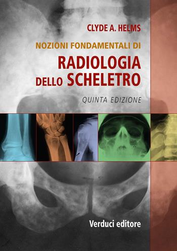 Radiologia dello scheletro. Nozioni fondamentali - Clyde A. Helms - Libro Verduci 2019 | Libraccio.it