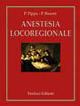 Anestesia locoregionale