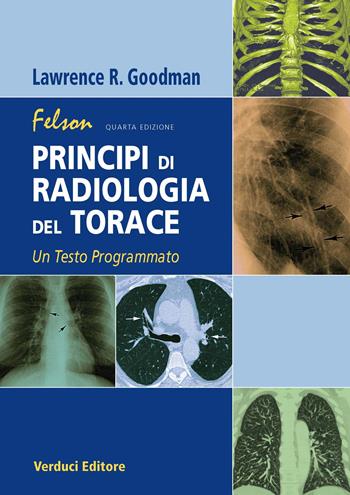 Felson. Principi di radiologia del torace. Un testo programmato - Lawrence R. Goodman - Libro Verduci 2018 | Libraccio.it
