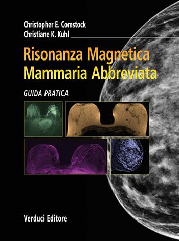 Risonanza magnetica mammaria abbreviata. Guida pratica - Christopher E. Comstock, Christiane K. Kuhl - Libro Verduci 2019 | Libraccio.it