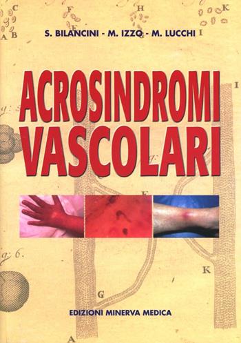 Acrosindromi vascolari - Salvino Bilancini, Marcello Izzo, Mario Lucchi - Libro Minerva Medica 2004, Specialità mediche | Libraccio.it