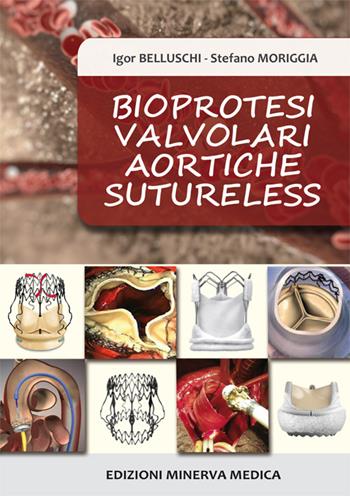 Bioprotesi valvolari aortiche sutureless - Igor Belluschi, Stefano Moriggia - Libro Minerva Medica 2015 | Libraccio.it