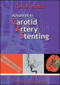Advances in carotid artery stenting - Carlo Setacci - Libro Minerva Medica 2013 | Libraccio.it