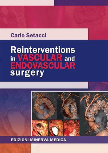 Reinterventions in vascular and endovascular surgery - Carlo Setacci - Libro Minerva Medica 2015 | Libraccio.it