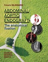 Abdominal aortic endograft. The anatomical fixation