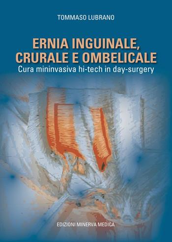 Ernia inguinale, crurale e ombelicale. Cura mininvasiva hi-tech in day surgery - Tommaso Lubrano - Libro Minerva Medica 2018 | Libraccio.it
