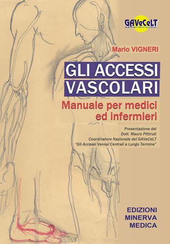 Gli accessi vascolari. Manuale per medici e infermieri - Mario Vigneri - Libro Minerva Medica 2018 | Libraccio.it