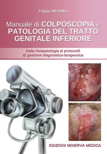 Manuale di colposcopia e patologia del tratto genitale inferiore. Dalla fisiologia ai protocolli di gestione diagnostico-terapeutica - Filippo Murina - Libro Minerva Medica 2018 | Libraccio.it