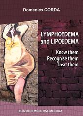 Lymphoedema and lipoedema. Know them. Recognise them. Treat them