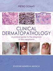 Clinical dermatopathology. A pratical guide to the diagnosis of skin neoplasms