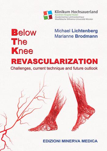 Below the knee revascularization. Challenges, current technique and future outlook - Michael Lichtenberg, Marianne Brodmann - Libro Minerva Medica 2019 | Libraccio.it