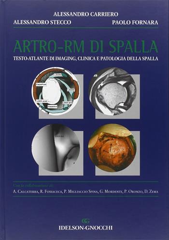Artro-RM di spalla. Testo atlante di imaging, clinica e patologia della spalla - Alessandro Carriero, Alessandro Stecco, Paolo Fornara - Libro Idelson-Gnocchi 2004 | Libraccio.it
