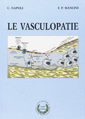 Le vasculopatie