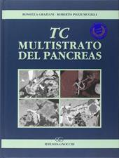 TC multistrato del pancreas