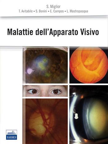 Malattie dell'apparato visivo  - Libro Edises 2014 | Libraccio.it