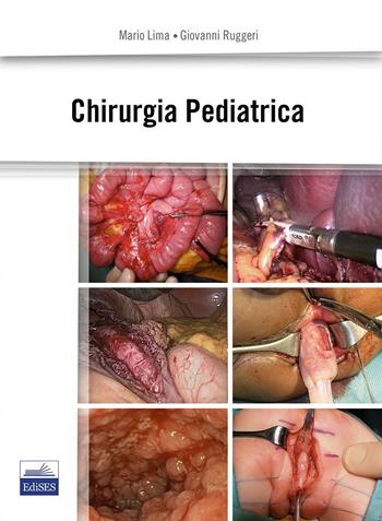 Chirurgia pediatrica - Mario Lima, Giovanni Ruggeri - Libro Edises 2015 | Libraccio.it