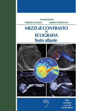 Mezzi di contrasto in ecografia. Testo atlante. Con DVD  - Libro Poletto Editore 2004 | Libraccio.it