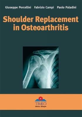 Shoulder replacement in osteoarthritis - Giuseppe Porcellini, Fabrizio Campi, Paolo Paladini - Libro Timeo 2005 | Libraccio.it