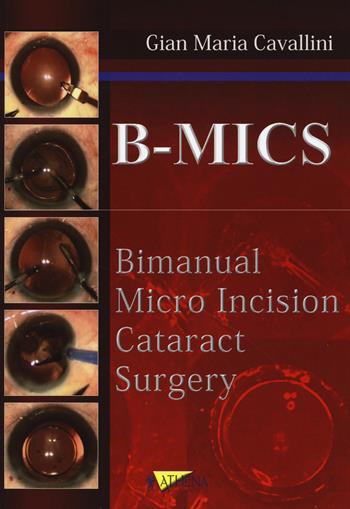 B-MICS Bimanual micro incision cataract surgery - Gian Maria Cavallini - Libro Athena Audiovisuals 2014 | Libraccio.it