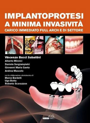 Implantoprotesi a minima invasività. Carico immediato full arch e di settore - Vincenzo Bucci Sabattini - Libro Griffin 2012 | Libraccio.it