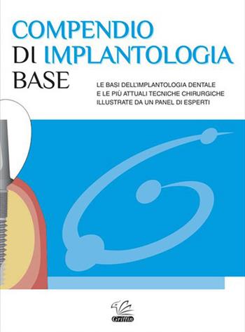 Compendio di implantologia base - Andrea Russo - Libro Griffin 2013 | Libraccio.it