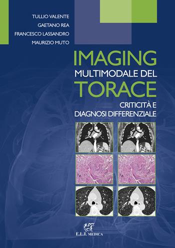 Imaging multimodale del torace. Criticità e diagnosi differenziale - Tullio Valente, Gaetano Rea, Francesco Lassandro - Libro ELI-Edizioni Librarie Int. 2016 | Libraccio.it