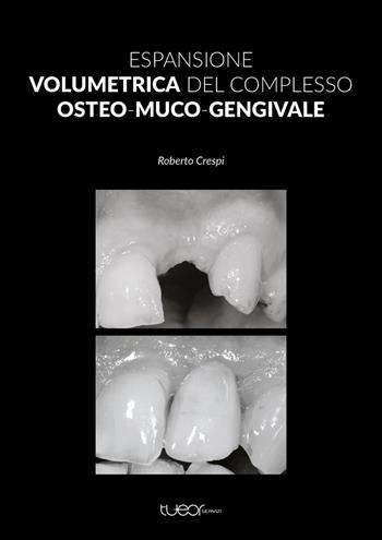 Espansione volumetrica del complesso osteo-muco-gengivale - Roberto Crespi - Libro TueorServizi 2021 | Libraccio.it