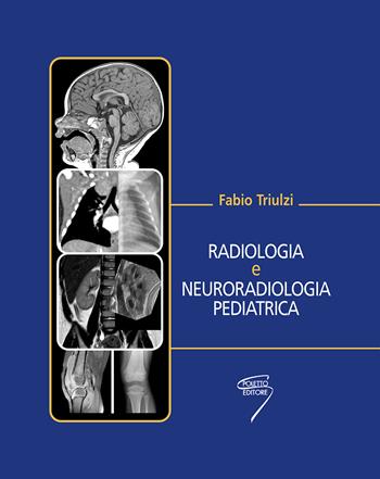 Radiologia e neuroradiologia pediatrica - Fabio Triulzi - Libro Poletto Editore 2010 | Libraccio.it
