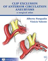 Clip exclusion of anterior circulation aneurysms: a surgical atlas. Con Contenuto digitale per download e accesso on line