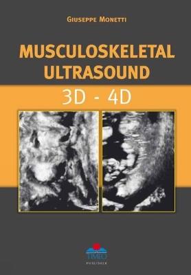 Musculoskeletal ultrasound. 3D-4D - Giuseppe Monetti - Libro Timeo 2011 | Libraccio.it