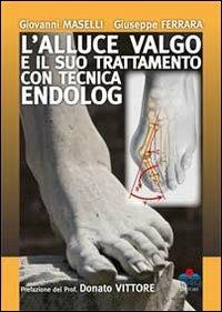 L'alluce valgo e il suo trattamento con tecnica endolog - Giovanni Maselli, Giuseppe Ferrara - Libro Timeo 2011 | Libraccio.it
