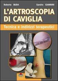 L'artroscopia di caviglia. Tecnica e indirizzi terapeutici - Sandro Giannini, Roberto Buda - Libro Timeo 2011 | Libraccio.it