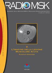 L'imaging della lesione muscolare acuta