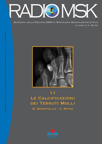 Le calcificazioni dei tessuti molli. Ediz. illustrata - Salvatore Donatiello, Vincenzo Spina - Libro Timeo 2018, Radio MSK. Quaderni della sezione SIRM | Libraccio.it