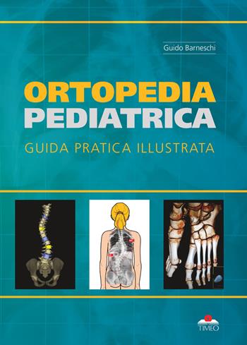 Ortopedia pediatrica. guida pratica illustrata. Ediz. illustrata - Guido Barneschi - Libro Timeo 2019 | Libraccio.it