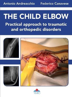 The child elbow. Practical approach to traumatic and orthopedic disorders - Antonio Andreacchio, Federico Canavese - Libro Timeo 2020 | Libraccio.it