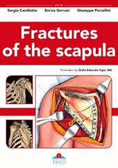 Fractures of the scapula. Ediz. illustrata