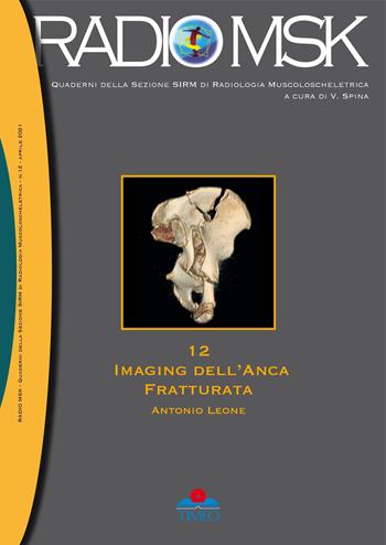 Imaging dell'anca fratturata - Antonio Leone - Libro Timeo 2021 | Libraccio.it