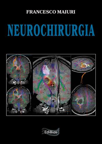 Neurochirurgia - Francesco Maiuri - Libro Edibios 2021 | Libraccio.it