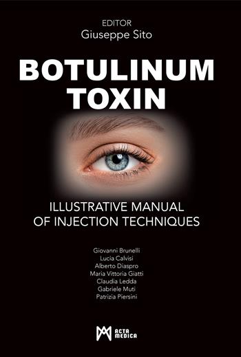 Botulinum toxin. Ilustrative manual of injection techniques. Ediz. a colori  - Libro Acta Medica Edizioni 2022 | Libraccio.it