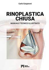 Rinoplastica chiusa. Manuale tecnico illustrato